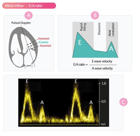 lv e|lv e' lateral velocity.